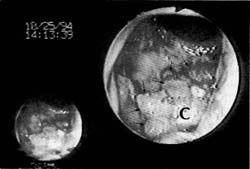 Fig. 1a