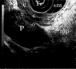 Fig. 1b