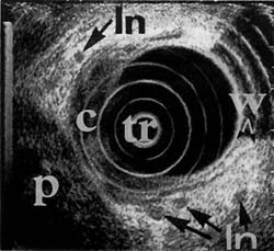 Fig. 1c