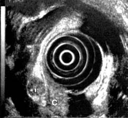 Fig. 2a