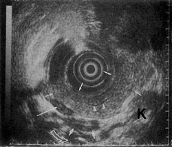 Fig. 1a