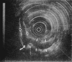Fig. 1a