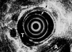 Fig. 2B