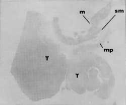 Fig. 9b