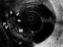 Fig. 9